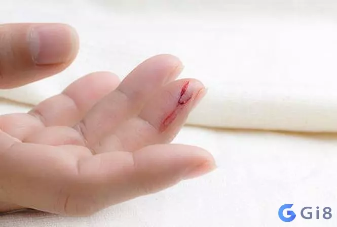 Giải đáp nhanh gọn đổ máu đánh con gì chọn số nhanh Giải đáp nhanh gọn đổ máu đánh con gì chọn số nhanh