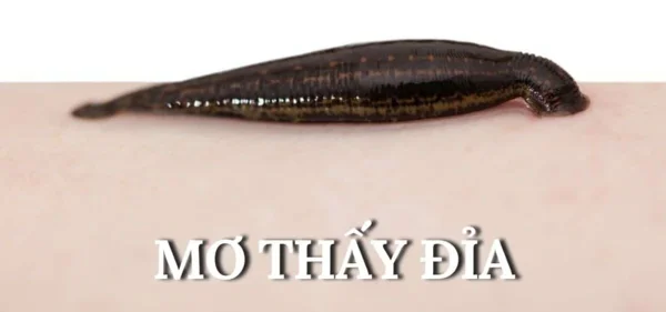 Ý nghĩa giấc mơ – Mơ bị đỉa cắn đánh con gì? Ý nghĩa giấc mơ - Mơ bị đỉa cắn đánh con gì?