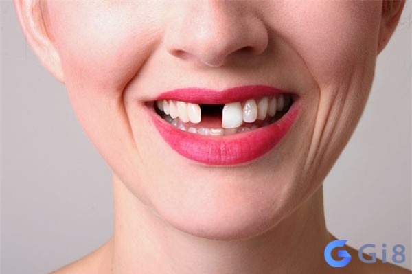 Nằm mơ thấy mình bị rụng răng cửa là điềm không tốt cho công việc Nằm mơ thấy mình bị rụng răng cửa là điềm không tốt cho công việc