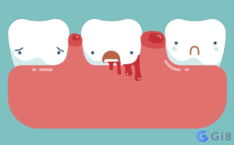 Mơ thấy răng bị rụng chảy máu có thể là dấu hiệu sức khỏe giảm sút Mơ thấy răng bị rụng chảy máu có thể là dấu hiệu sức khỏe giảm sút