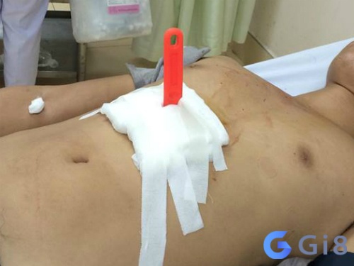 Ngủ mơ thấy bị dao đâm vào bụng và chảy máu là lời nhắc nhở bạn cần cảnh giác để tránh bị chơi xấu, đạp đổ chén cơm Ngủ mơ thấy bị dao đâm vào bụng và chảy máu là lời nhắc nhở bạn cần cảnh giác để tránh bị chơi xấu, đạp đổ chén cơm