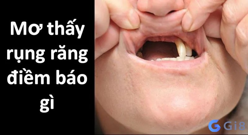 Liệu điềm báo gì xuất hiện khi nằm mơ thấy rụng răng Liệu điềm báo gì xuất hiện khi nằm mơ thấy rụng răng