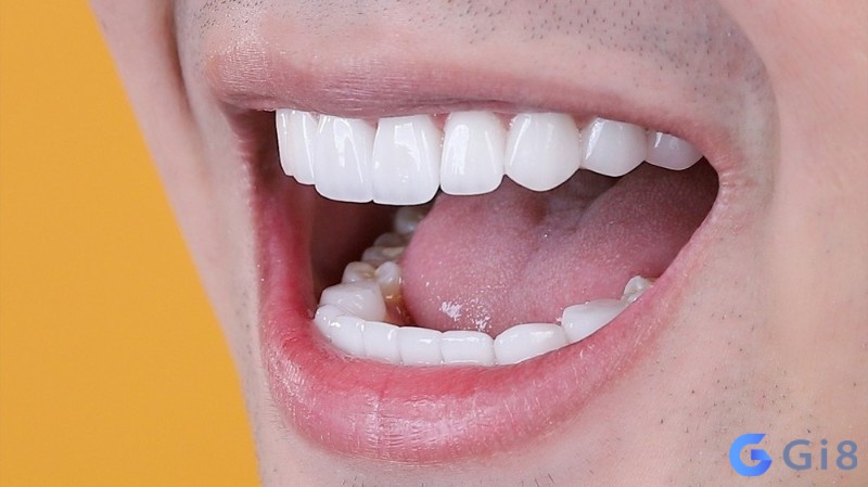 Mơ răng đánh con gì được nhiều anh em đề thủ quan tâm Mơ răng đánh con gì được nhiều anh em đề thủ quan tâm