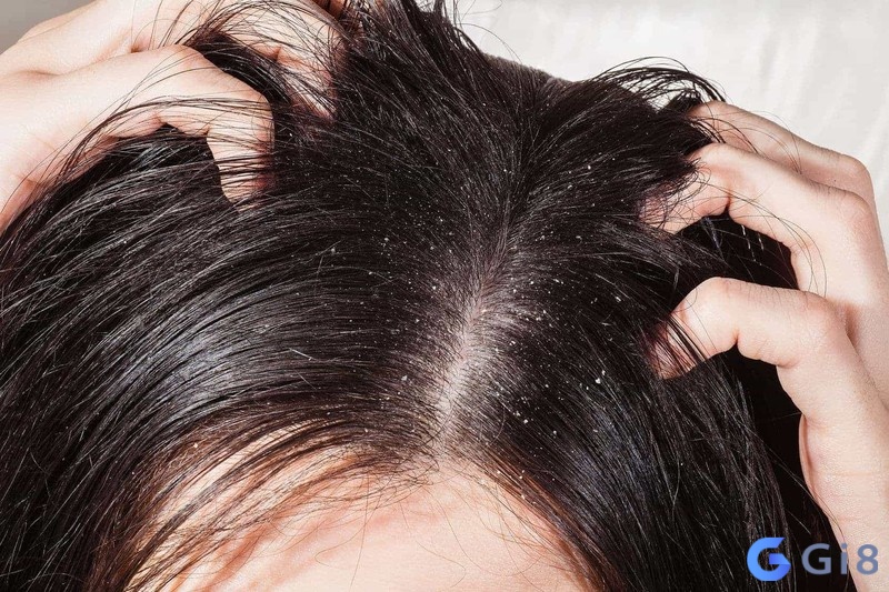 Ngủ và chiêm bao thấy kiến bò lên trên đỉnh đầu là điềm báo cho mùa màng bội thu, lương thực đầy nhà Ngủ và chiêm bao thấy kiến bò lên trên đỉnh đầu là điềm báo cho mùa màng bội thu, lương thực đầy nhà