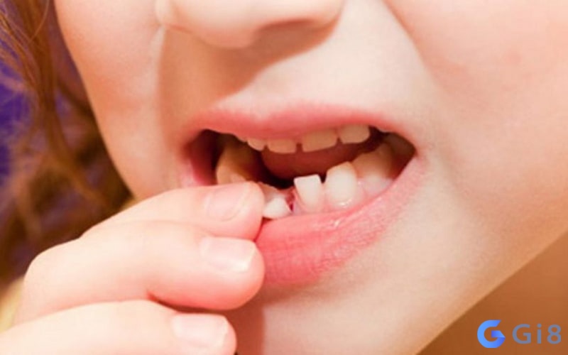 Gãy răng hàm dưới là báo hiệu người thân không khỏe, nếu bạn mơ thấy gãy răng đánh con gì Mất một chiếc răng hàm dưới là báo hiệu người thân không khỏe. Mơ thấy gãy răng đánh con gì?