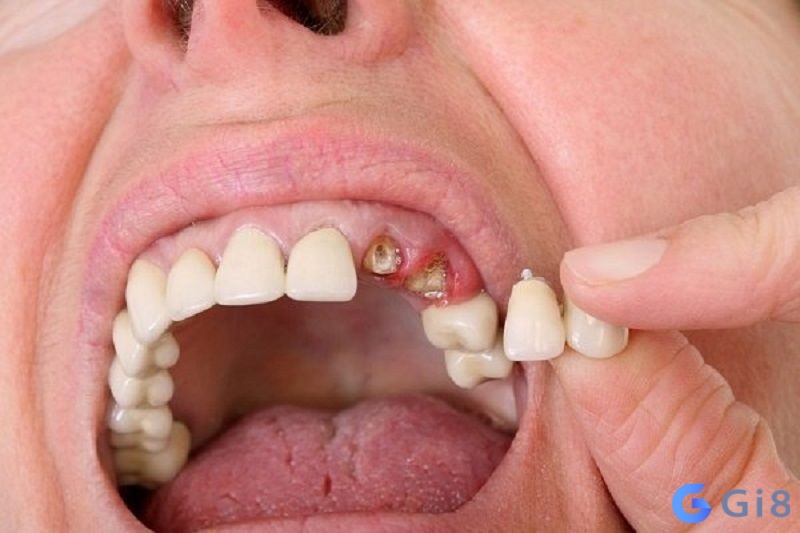 Mỗi chiêm bao mang tới dự báo nhất định tùy tình tiết Mỗi chiêm bao mang tới dự báo nhất định tùy tình tiết