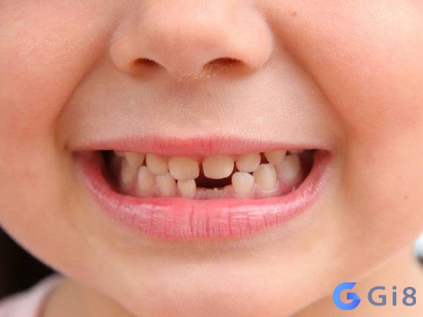 Chiêm bao thấy bị rụng răng mang tới ý nghĩa vô cùng đặc biệt Chiêm bao thấy bị rụng răng mang tới ý nghĩa vô cùng đặc biệt