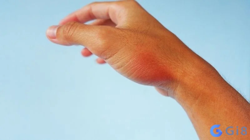 Mơ thấy rết cắn vào tay thể hiện bạn đang gặp khó khăn trong việc thể hiện bản thân Mơ thấy rết cắn vào tay thể hiện bạn đang gặp khó khăn trong việc thể hiện bản thân